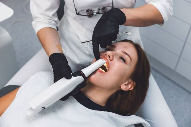 Best Knocked-Out Tooth (Avulsed Tooth) Treatment in Ogden, UT